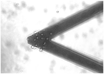 Correlating nanoscale motion and ATP production in healthy and favism erythrocytes: a real-time nanomotion sensor study